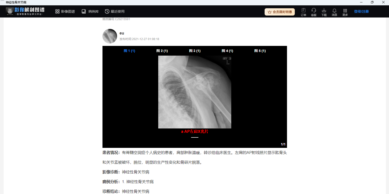 Ӱ�����ͼ��64λ��ͼ5